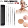 Blackhead Pimple Acne Extractor Remover Kit